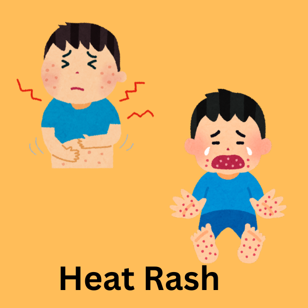 Heat rash
