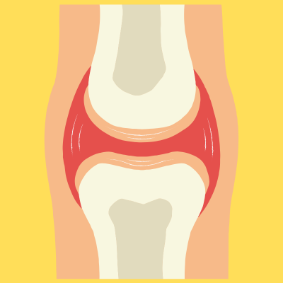 Cartilage