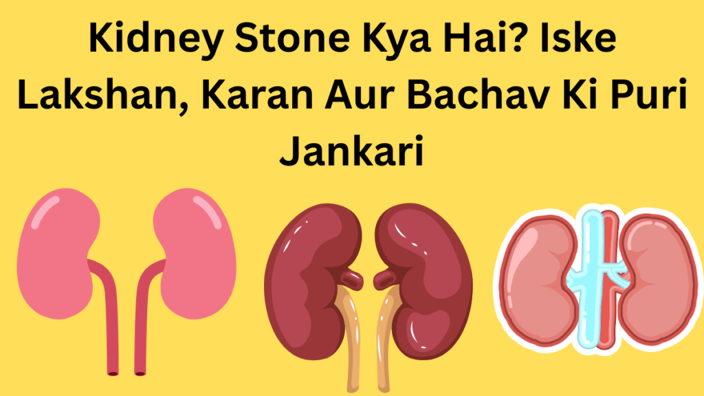 Kidney Stone Kya Hai? Iske Lakshan, Karan Aur Bachav Ki Puri Jankari