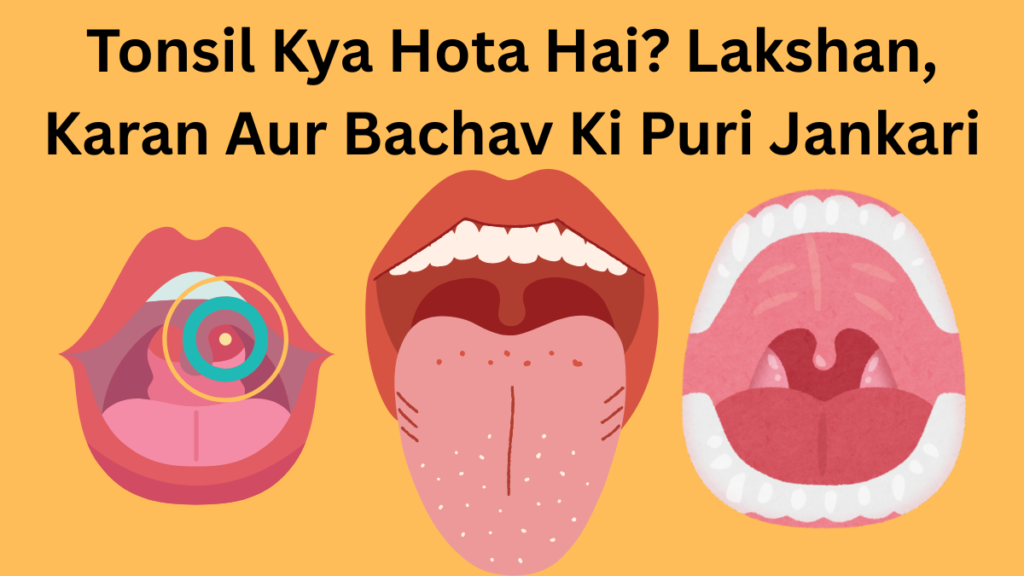 Tonsil Kya Hota Hai? Lakshan, Karan Aur Bachav Ki Puri Jankari